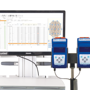 Epilepsi Cerrahisi Sistemleri